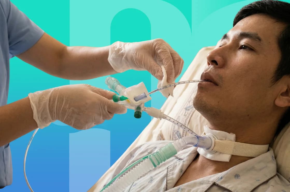 Chăm sóc mở khí quản