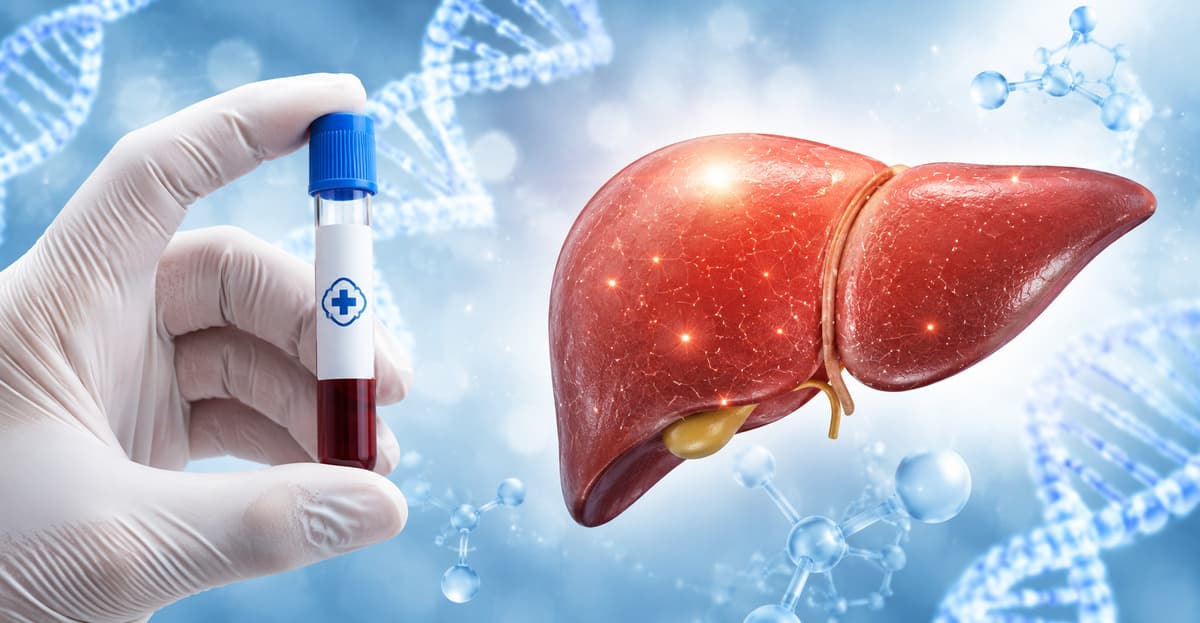Xét nghiệm định lượng virus viêm gan B có ý nghĩa gì?