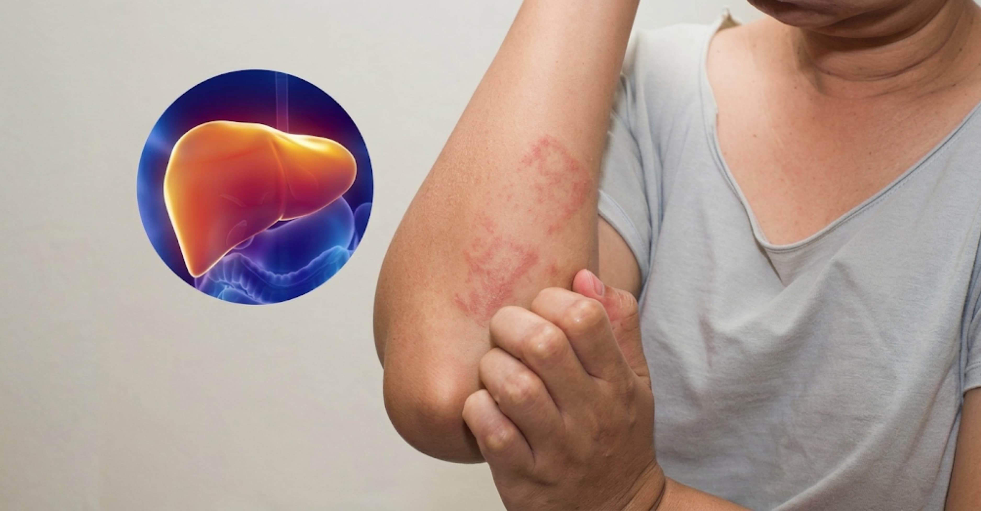 9 dấu hiệu ung thư gan giai đoạn đầu dễ nhận biết