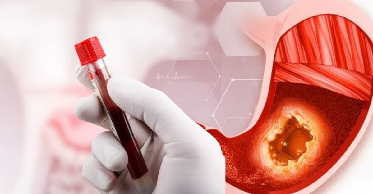 Marker ung thư dạ dày là gì? Có giúp phát hiện bệnh sớm không?