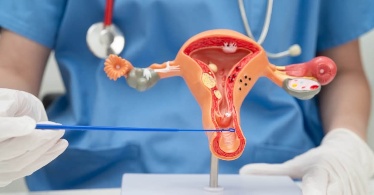 Ung thư cổ tử cung có lây không và con đường lây truyền HPV