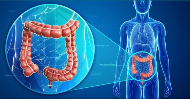 9 dấu hiệu ung thư đại tràng sớm và cách nhận biết chính xác