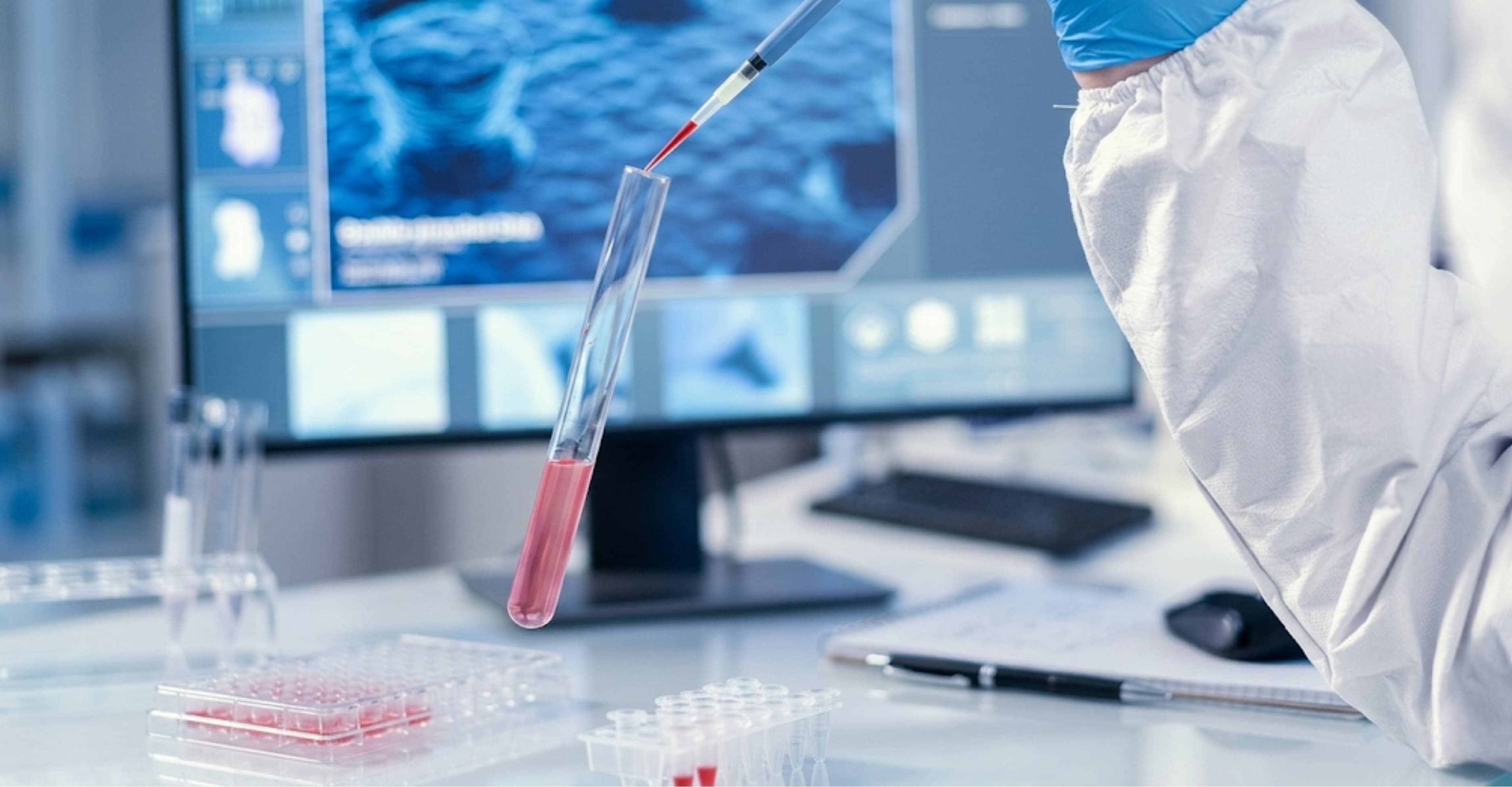 Sàng lọc Thalassemia là gì? Quy trình và lưu ý khi xét nghiệm