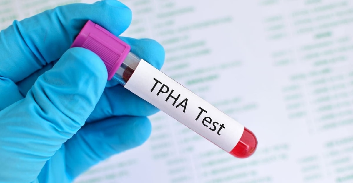 Xét nghiệm TPHA là gì? Thực hiện khi nào để có kết quả đúng?