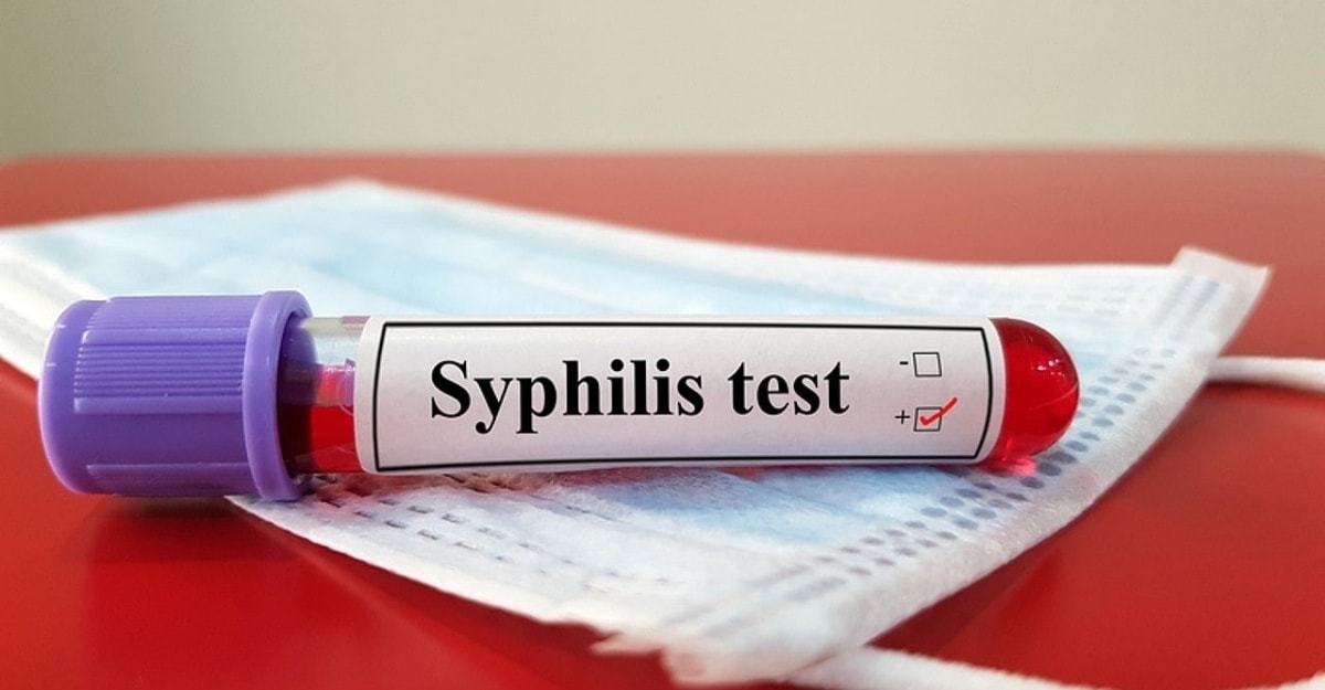 Xét nghiệm Syphilis là gì? Các phương pháp tầm soát giang mai