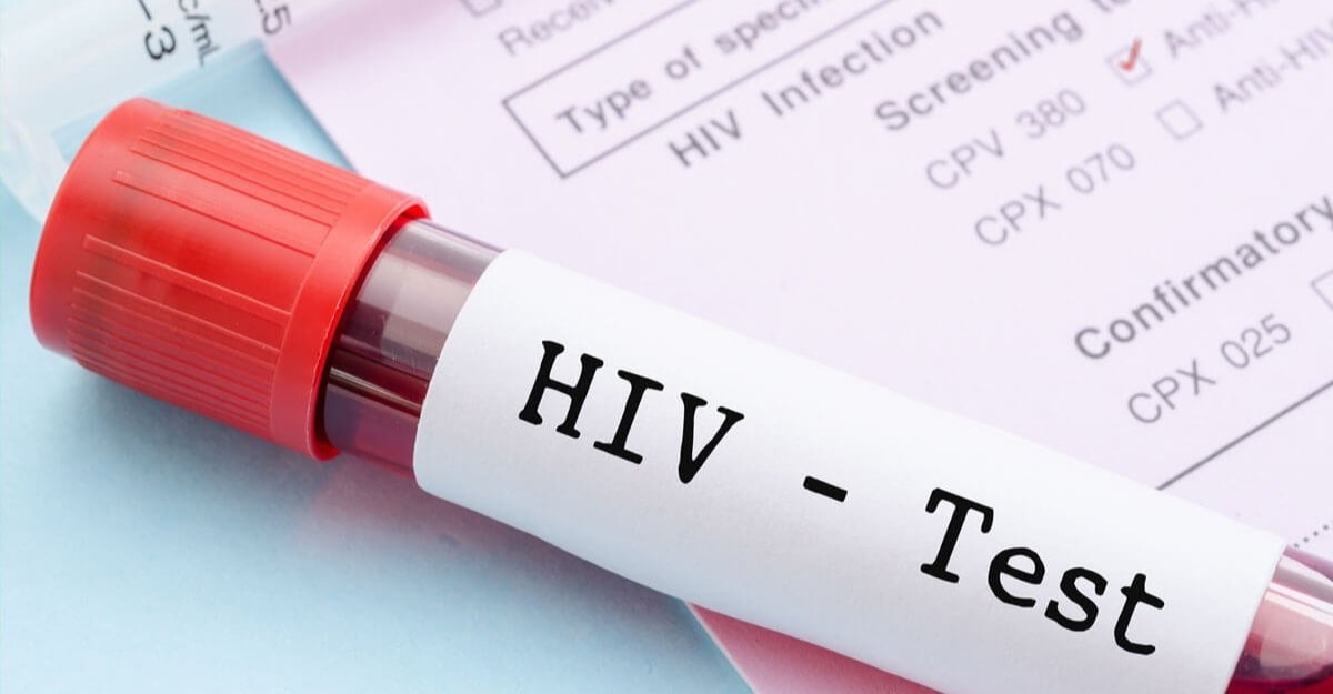 Tổng hợp các cách xét nghiệm HIV chính xác, an toàn và bảo mật