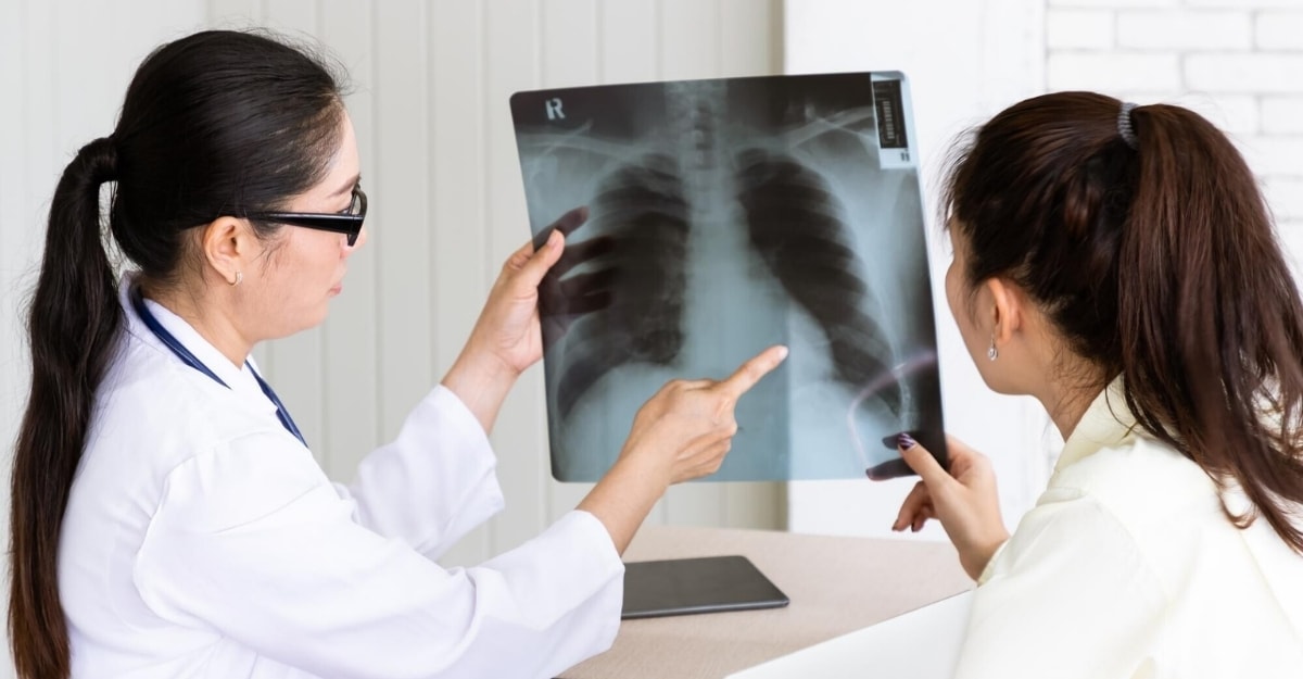 Ung thư phổi có di truyền không? Tỷ lệ và dấu hiệu nhận biết