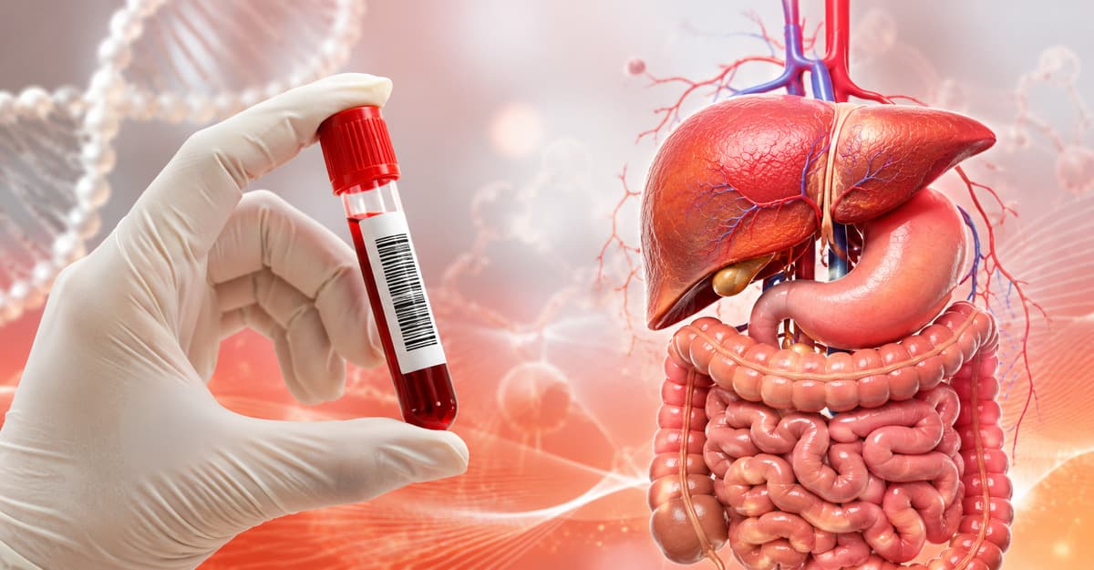 Giải mã ý nghĩa xét nghiệm marker ung thư