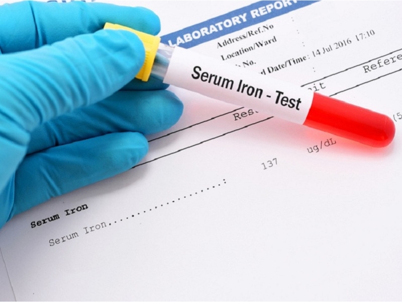 Xét nghiệm sắt huyết thanh giúp phân biệt Thalassemia với thiếu máu thiếu sắt