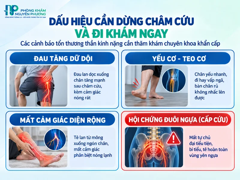 Dấu hiệu cảnh báo cần dừng châm cứu đi khám ngay