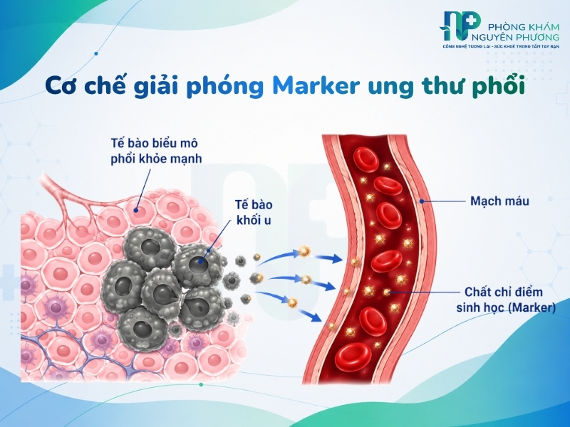Các tế bào ác tính ở phổi giải phóng protein đặc hiệu vào lòng mạch máu