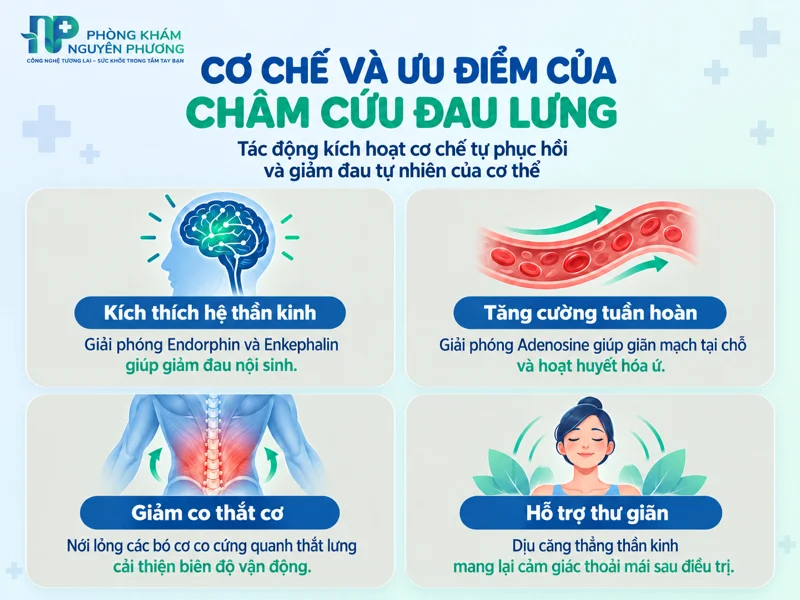 Cơ chế tác động và ưu điểm của châm cứu đau lưng