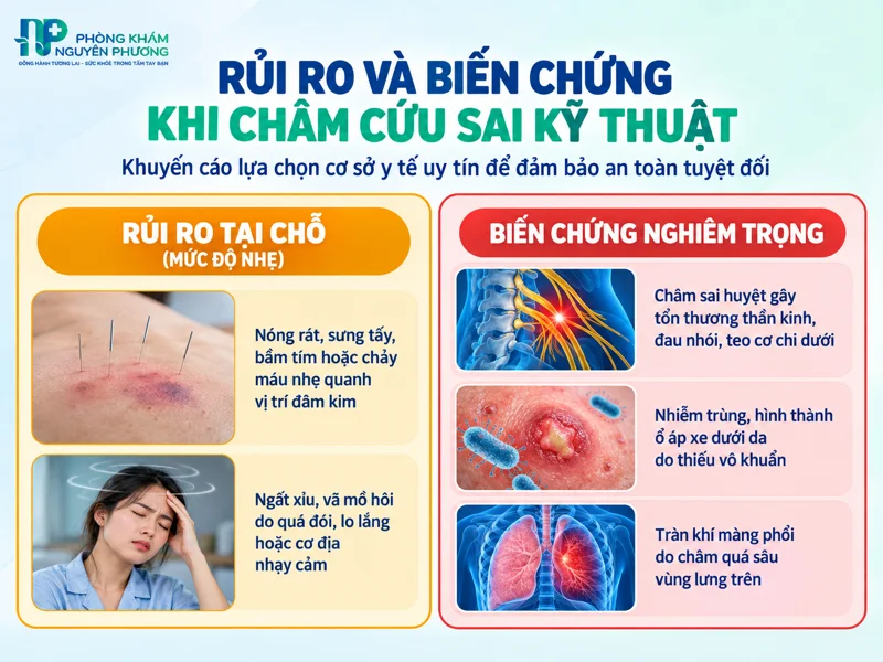 Phân loại rủi ro và biến chứng khi châm cứu sai kỹ thuật