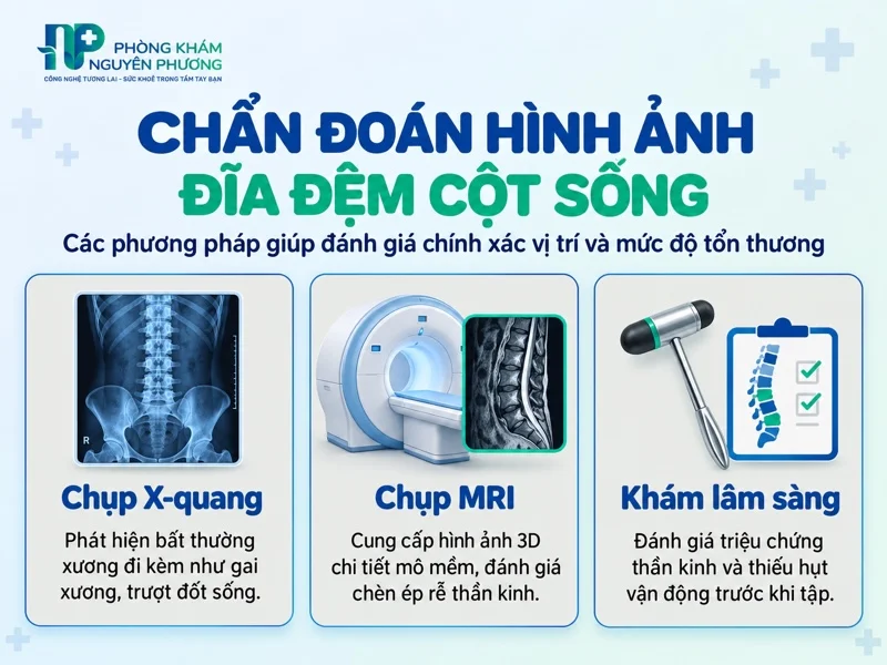 Phương pháp chẩn đoán tổn thương đĩa đệm cột sống thắt lưng