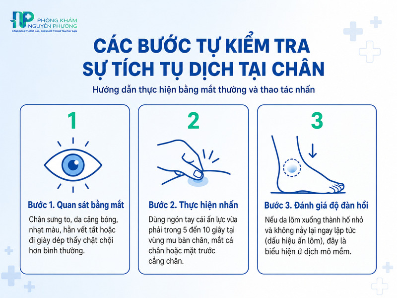 Các bước đơn giản tự đánh giá mức độ phù chân tại nhà