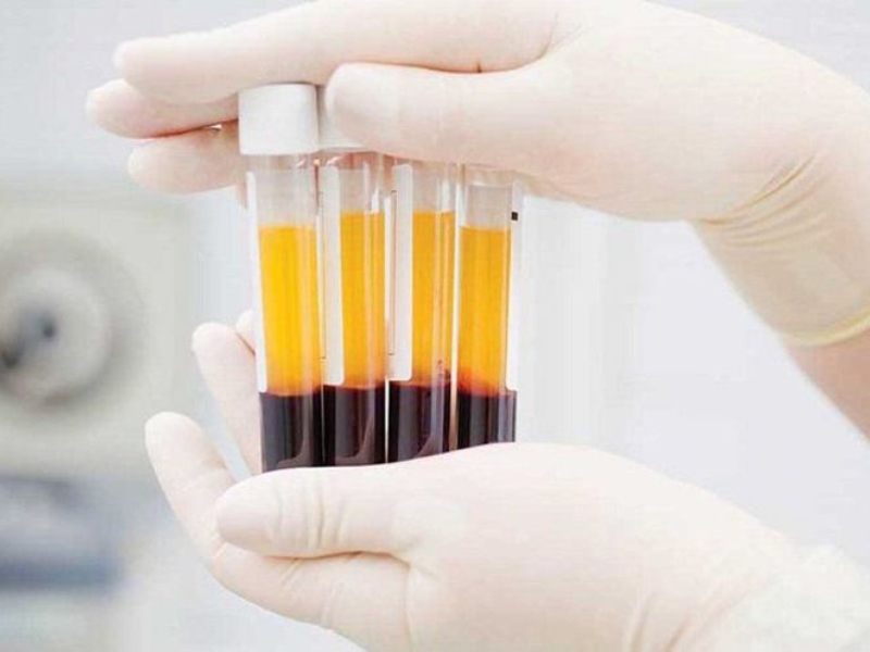 Xét nghiệm huyết thanh ít dùng để chẩn đoán cúm A cấp