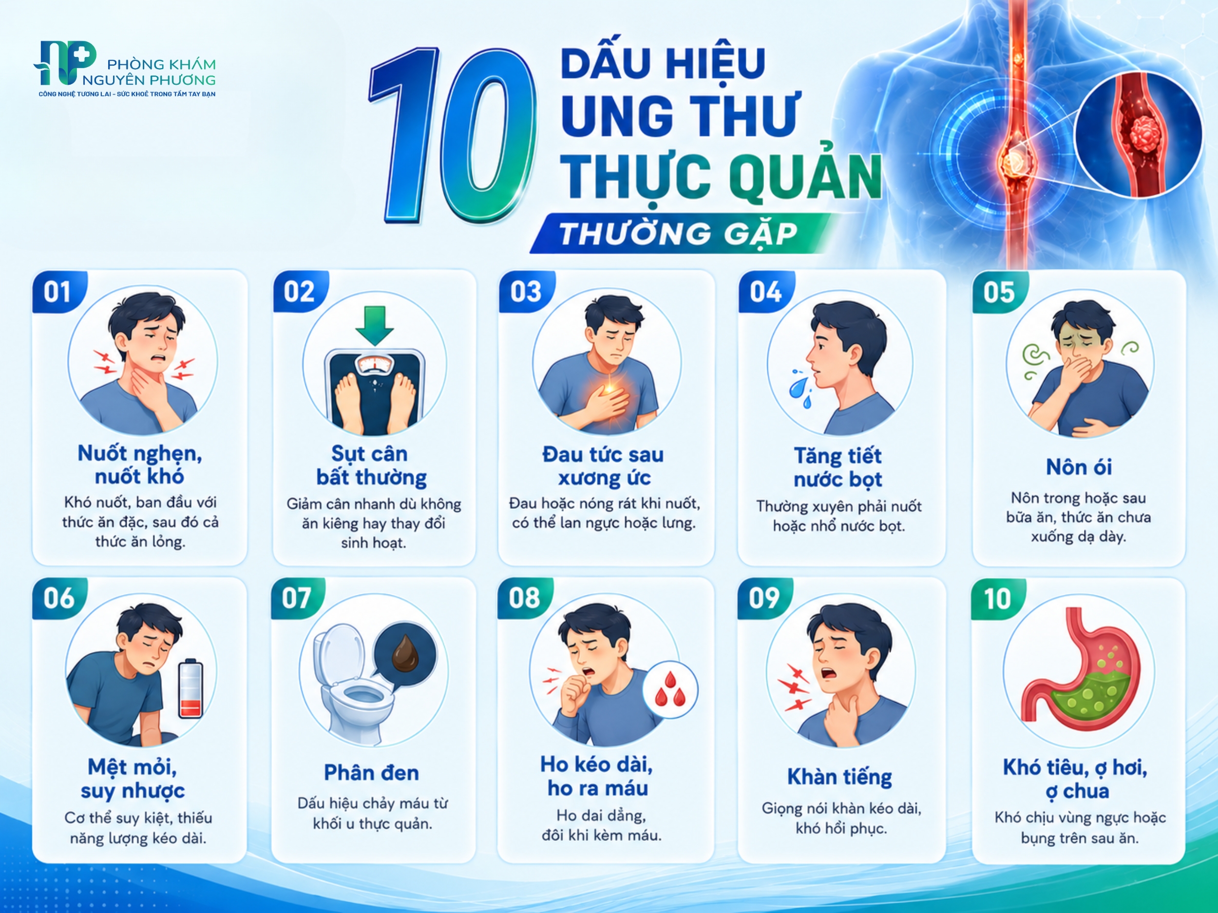 Nhận biết sớm các dấu hiệu cảnh báo ung thư thực quản nguy hiểm