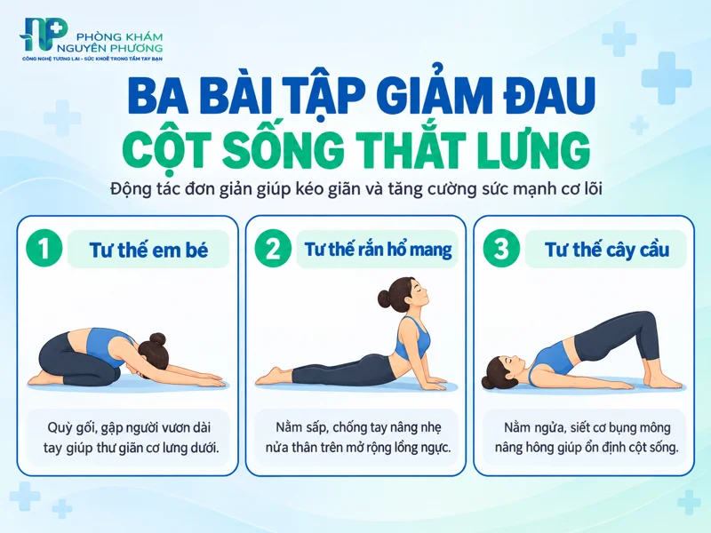Ba bài tập hỗ trợ giảm đau thoát vị đĩa đệm tại nhà