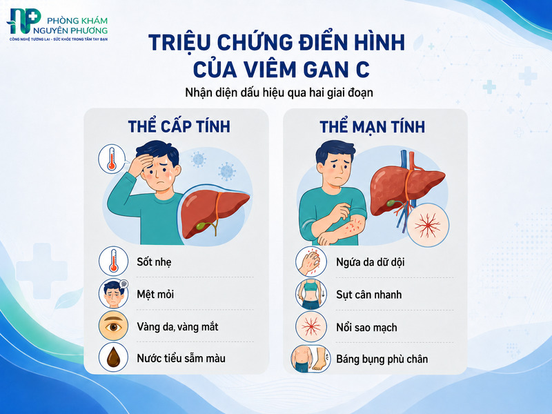 Các triệu chứng cảnh báo bệnh viêm gan C điển hình