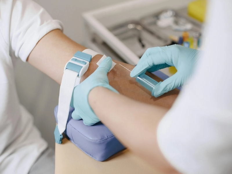 Kỹ thuật viên y tế tiến hành lấy mẫu máu để phân tích kháng thể kháng virus HSV