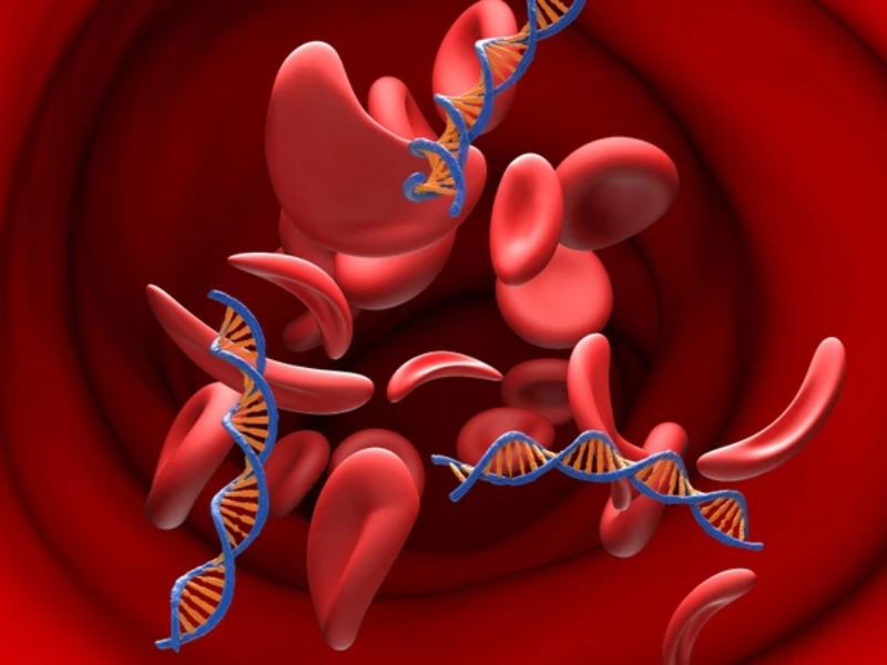 Điện di huyết sắc tố giúp phân tích các loại Hemoglobin và hỗ trợ chẩn đoán Thalassemia