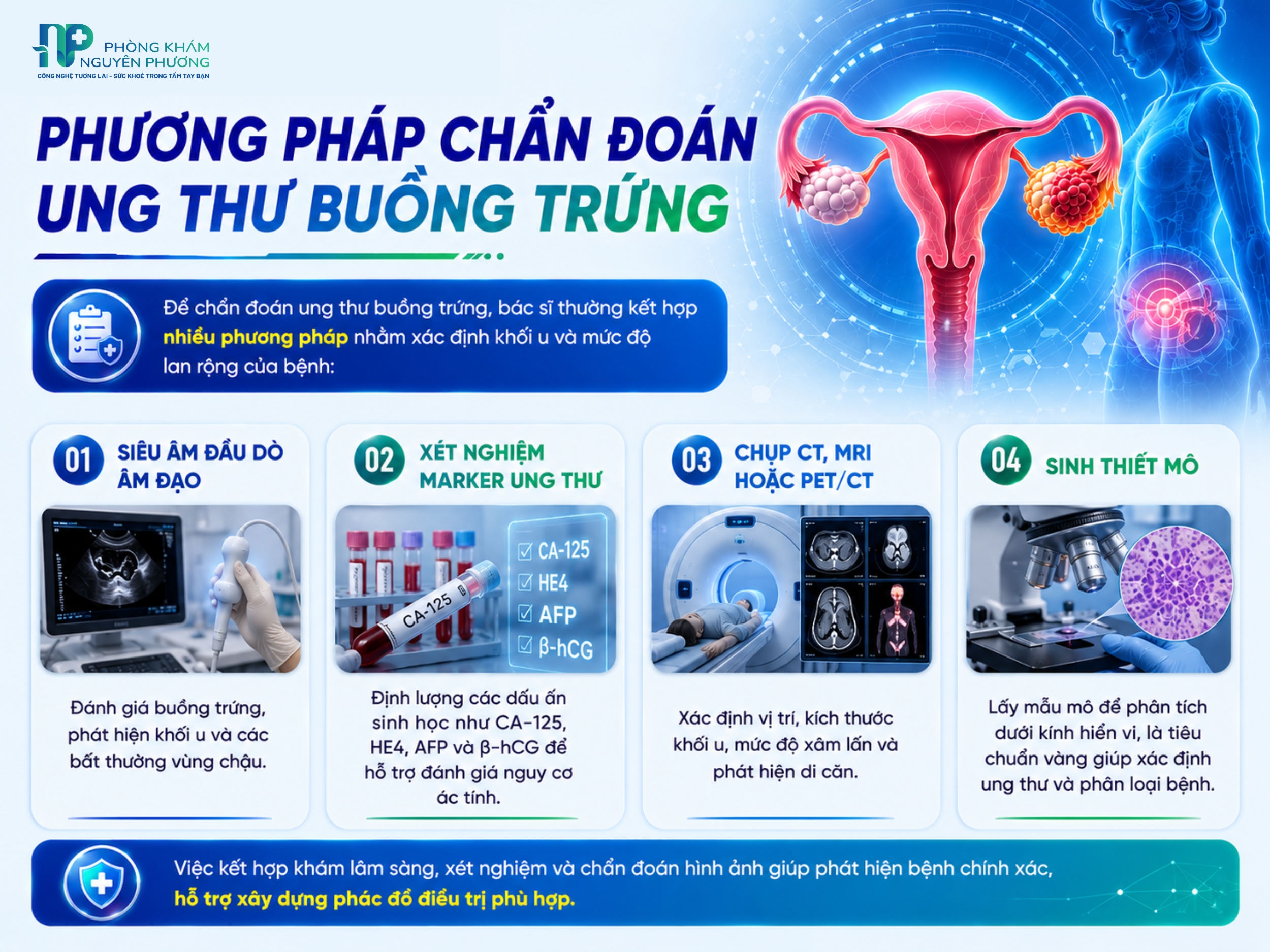 Chẩn đoán chính xác giúp phát hiện sớm ung thư buồng trứng