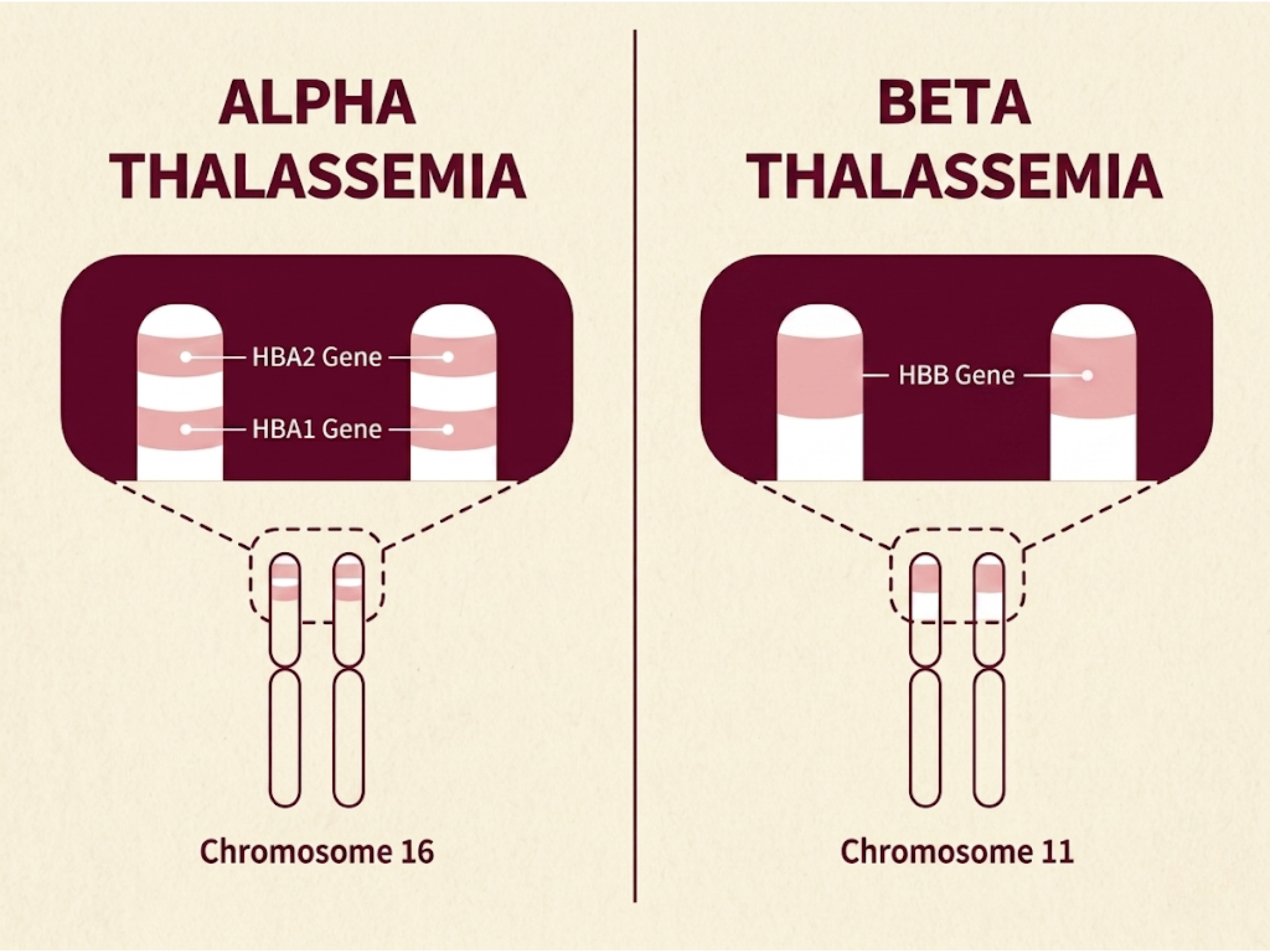 Alpha và Beta Thalassemia là hai dạng gen Thalassemia phổ biến