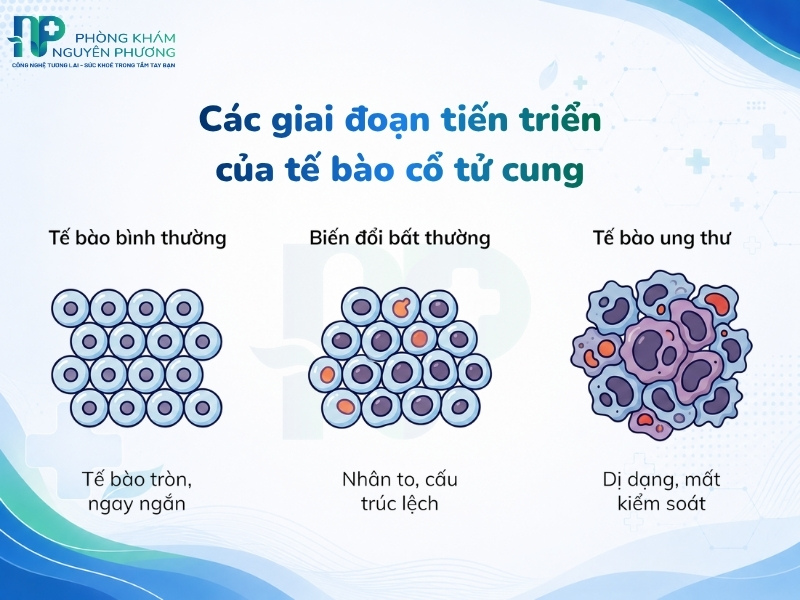 Sự biến đổi cấu trúc tế bào từ bình thường tiến triển âm ỉ thành ung thư
