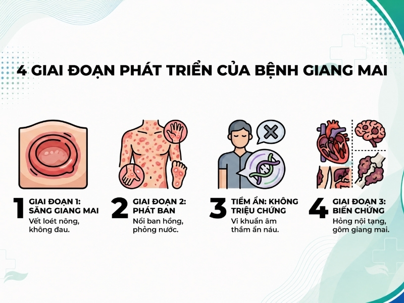 Diễn tiến 4 giai đoạn lâm sàng của bệnh giang mai