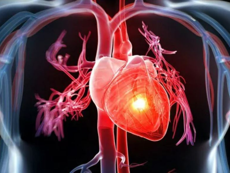 Truyền nước biển có thể gây quá tải tuần hoàn, làm tăng gánh thể tích cho tim và thận