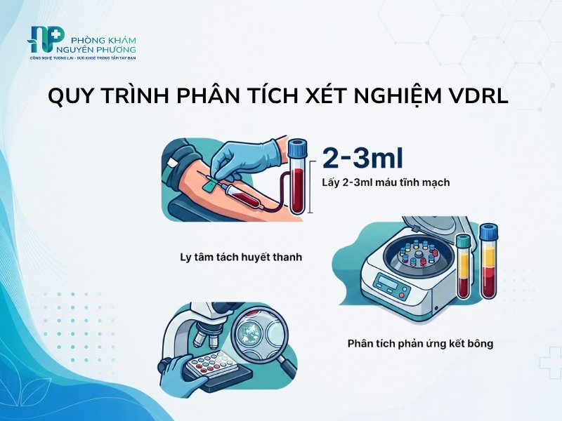 Quy trình 3 bước lấy mẫu và phân tích xét nghiệm VDRL