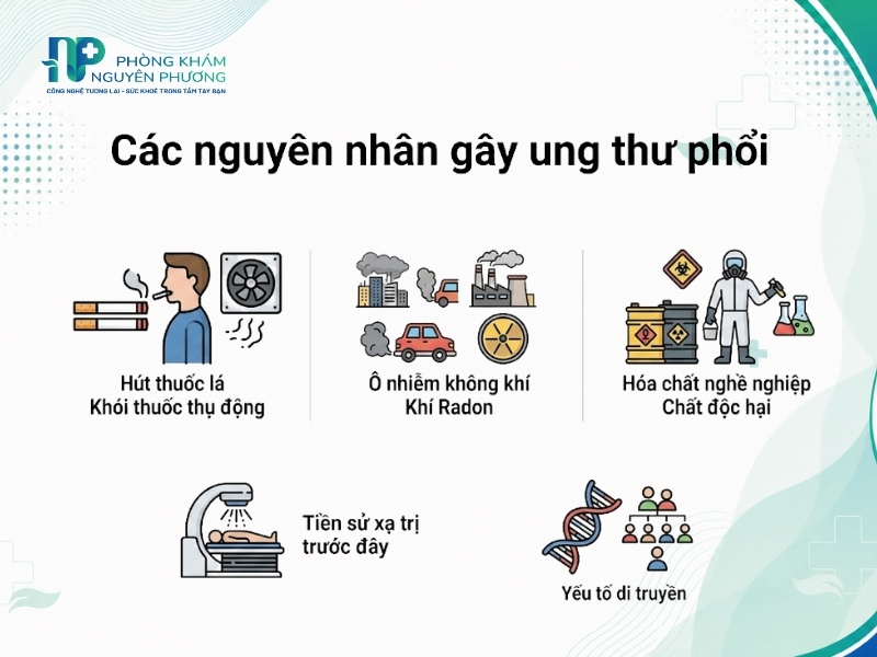 Nguyên nhân làm tăng nguy cơ mắc ung thư phổi