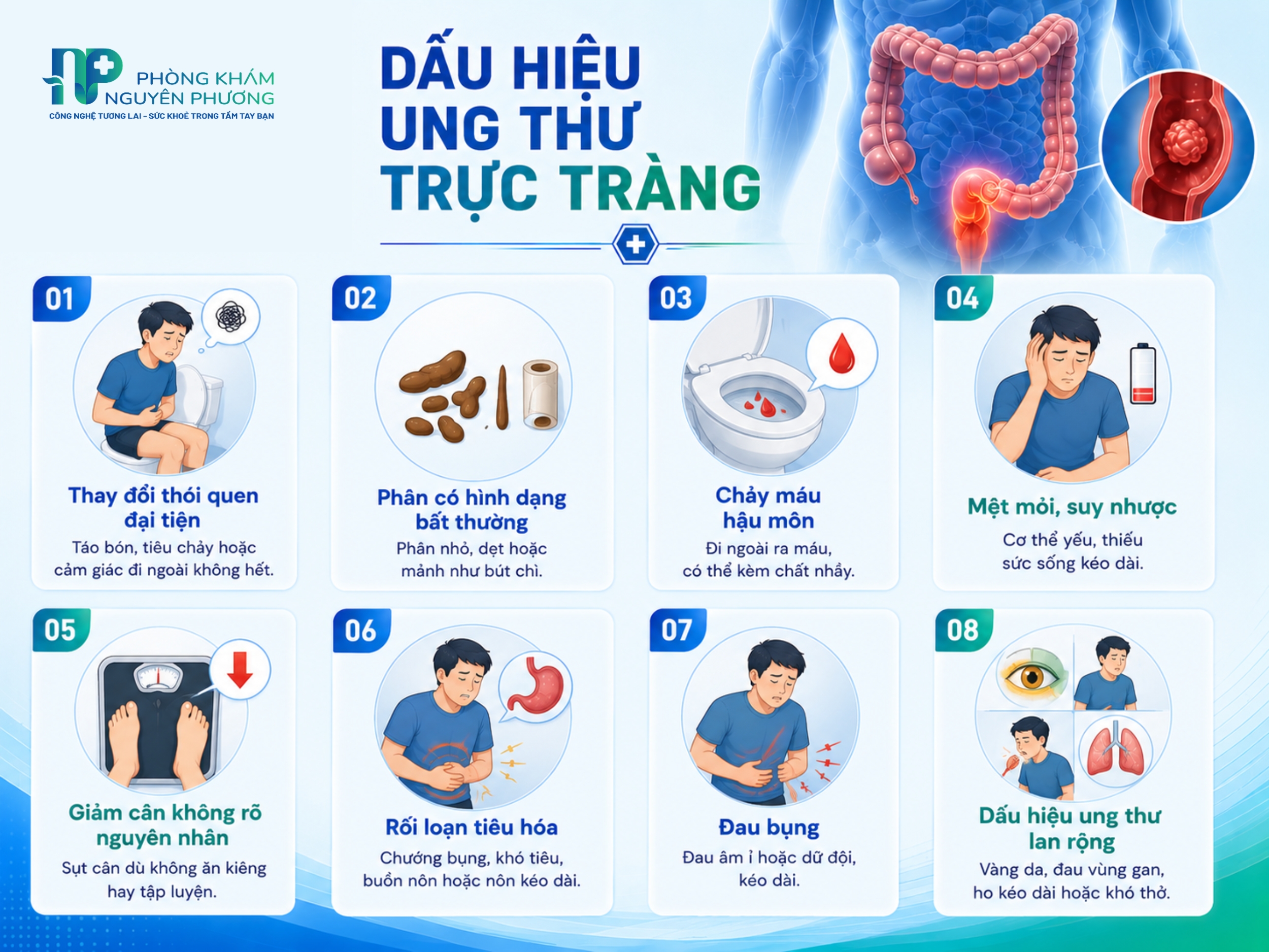 Dấu hiệu cảnh báo ung thư trực tràng