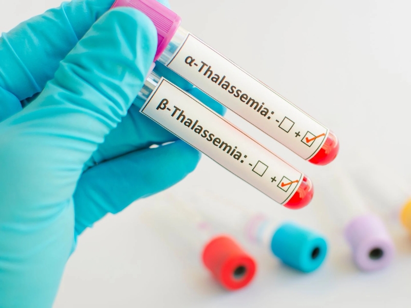 Thalassemia gồm 2 nhóm chính là Alpha Thalassemia và Beta Thalassemia với mức độ ảnh hưởng khác nhau