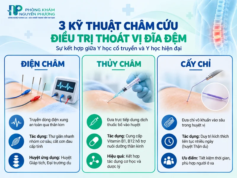 Các kỹ thuật châm cứu thoát vị đĩa đệm phổ biến