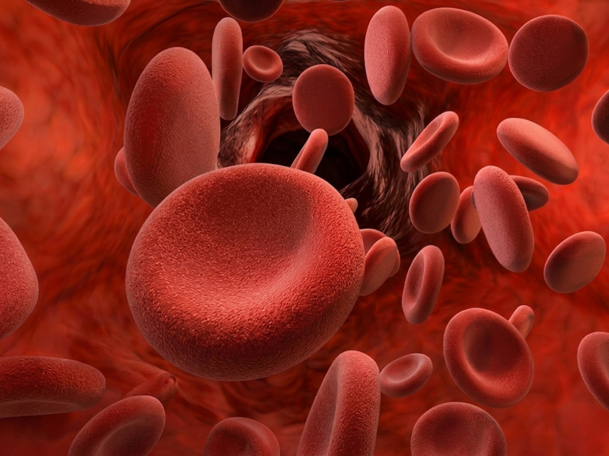Thalassemia (tan máu bẩm sinh) là bệnh di truyền ảnh hưởng đến quá trình tạo huyết sắc tố trong cơ thể