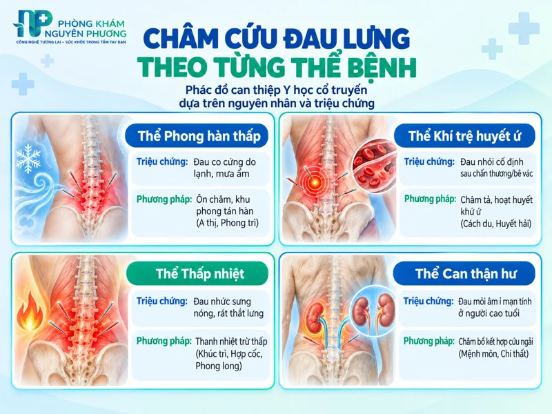 Phân loại thể bệnh đau lưng và phương pháp châm cứu YHCT