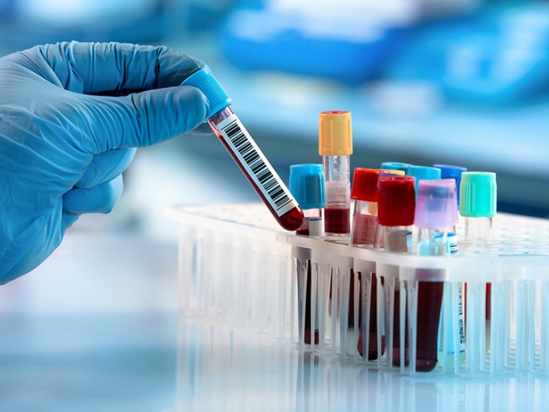 Xét nghiệm huyết đồ là bước ưu tiên đầu tiên khi nghi ngờ Thalassemia hoặc thiếu máu