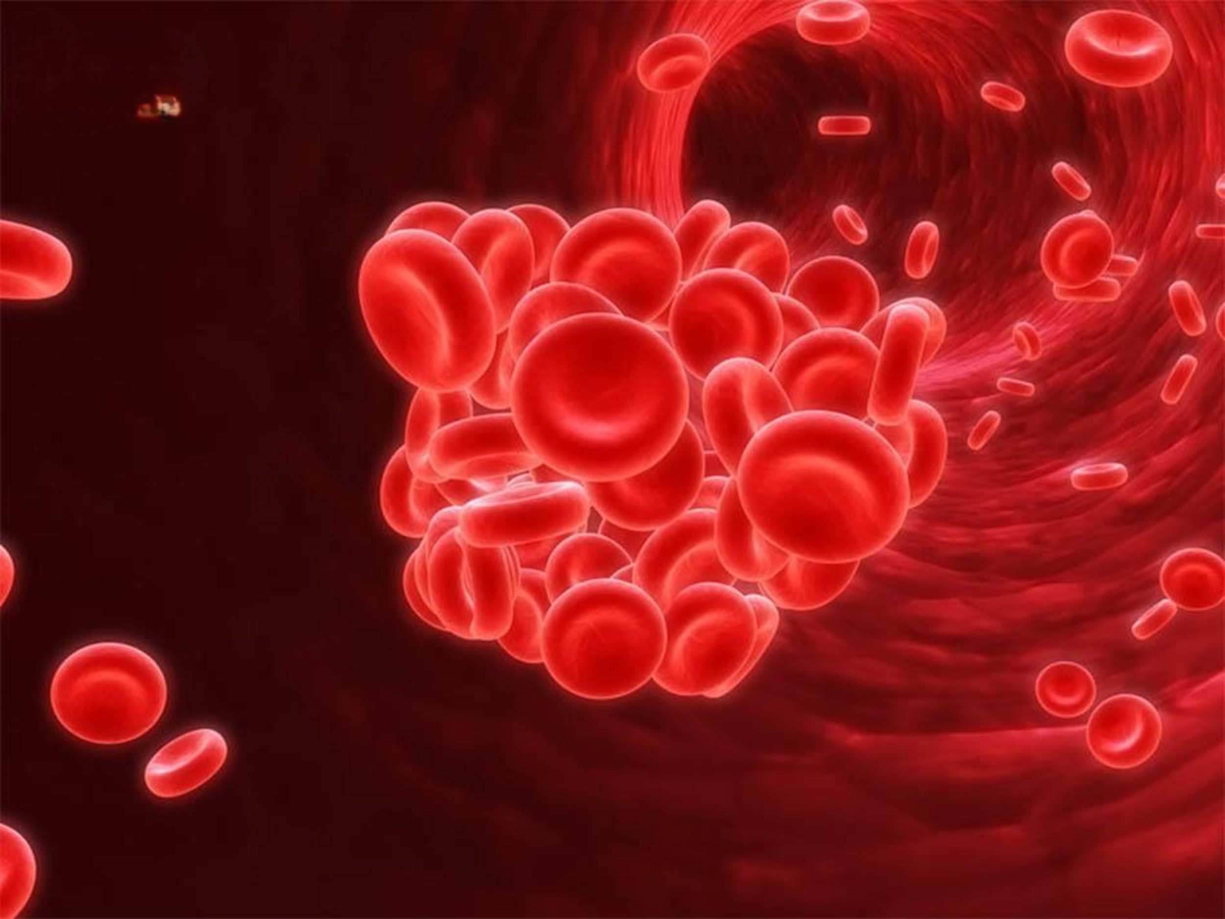 Alpha Thalassemia là bệnh tan máu bẩm sinh do rối loạn tổng hợp chuỗi alpha-globin