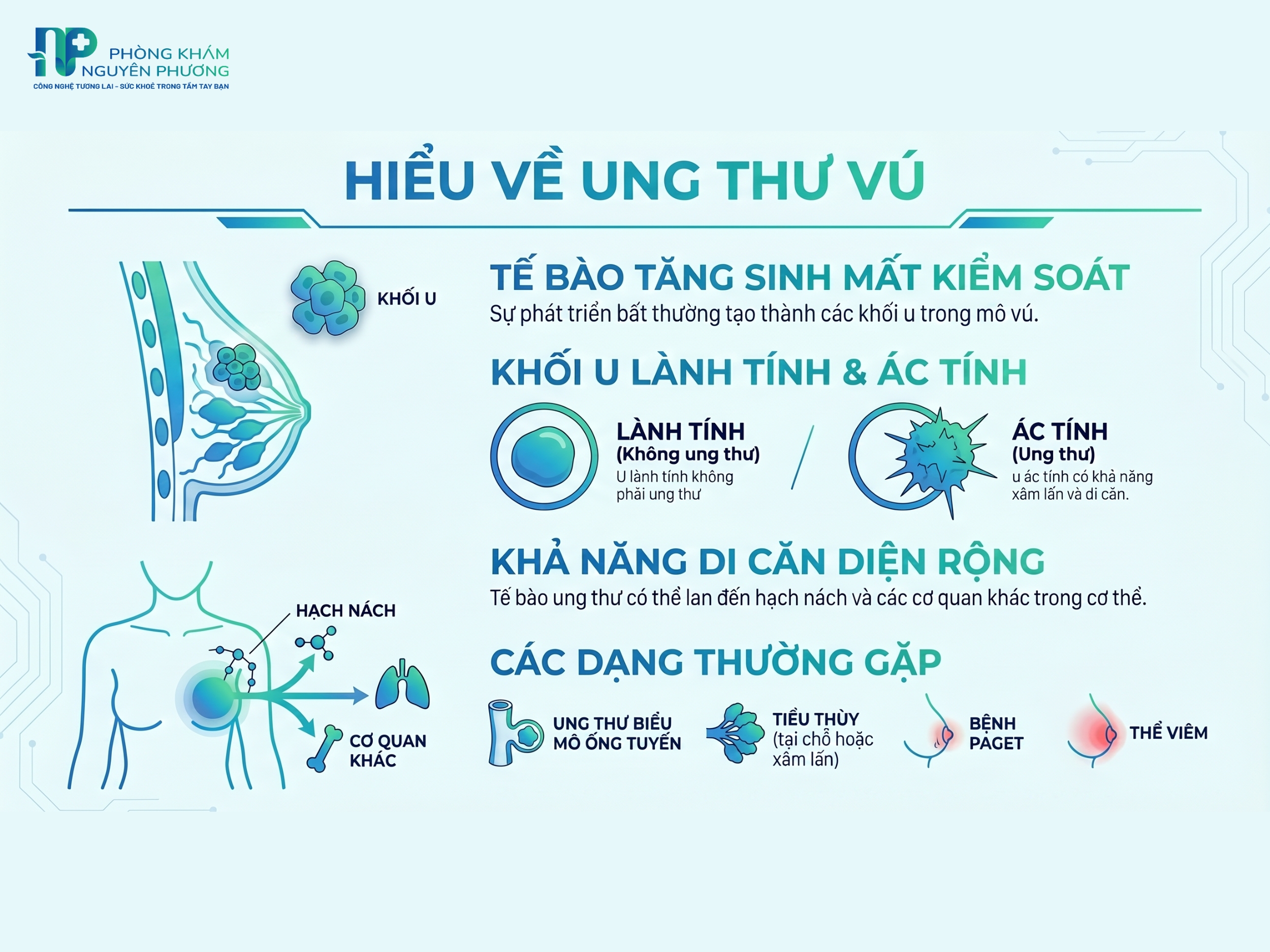 Tổng quan về ung thư vú