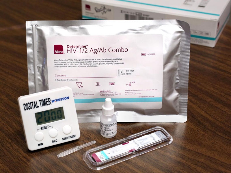 Xét nghiệm HIV Combo Ag/Ab giúp phát hiện kháng thể HIV và kháng nguyên p24 trong mẫu máu