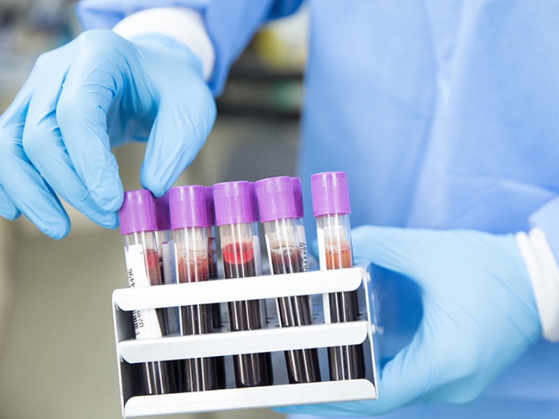 Điện di huyết sắc tố giúp đánh giá các thành phần hemoglobin