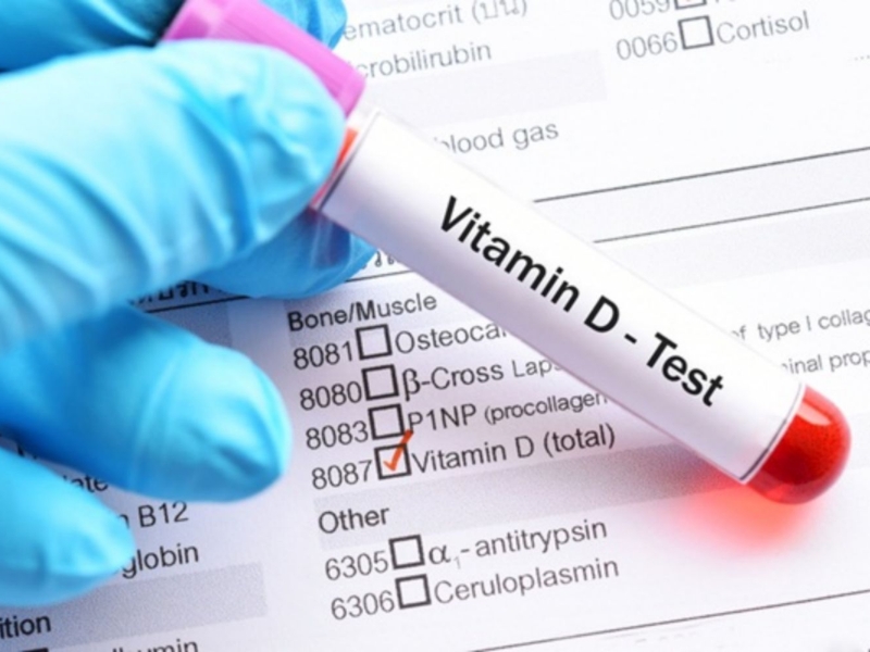 Xét nghiệm vitamin giúp phát hiện thiếu hụt; cần nhịn ăn và ngưng bổ sung trước khi thực hiện